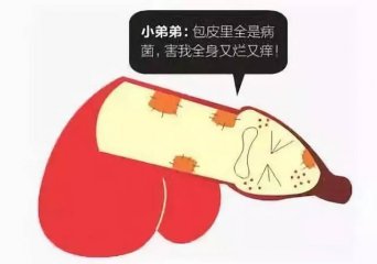 �ճ����������Ԥ����ͷ��